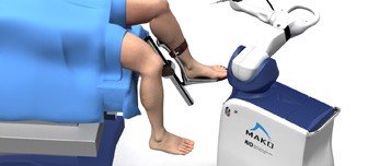 Robotic Assisted Replacements
